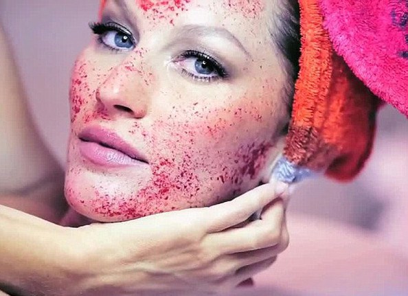 Vampire Facial Gisele vampirefacial — image courtesy of vampirefacial.com