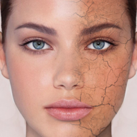 Seasonal Dry Skin botanicabazaar — image courtesy of botanicabazaar.com