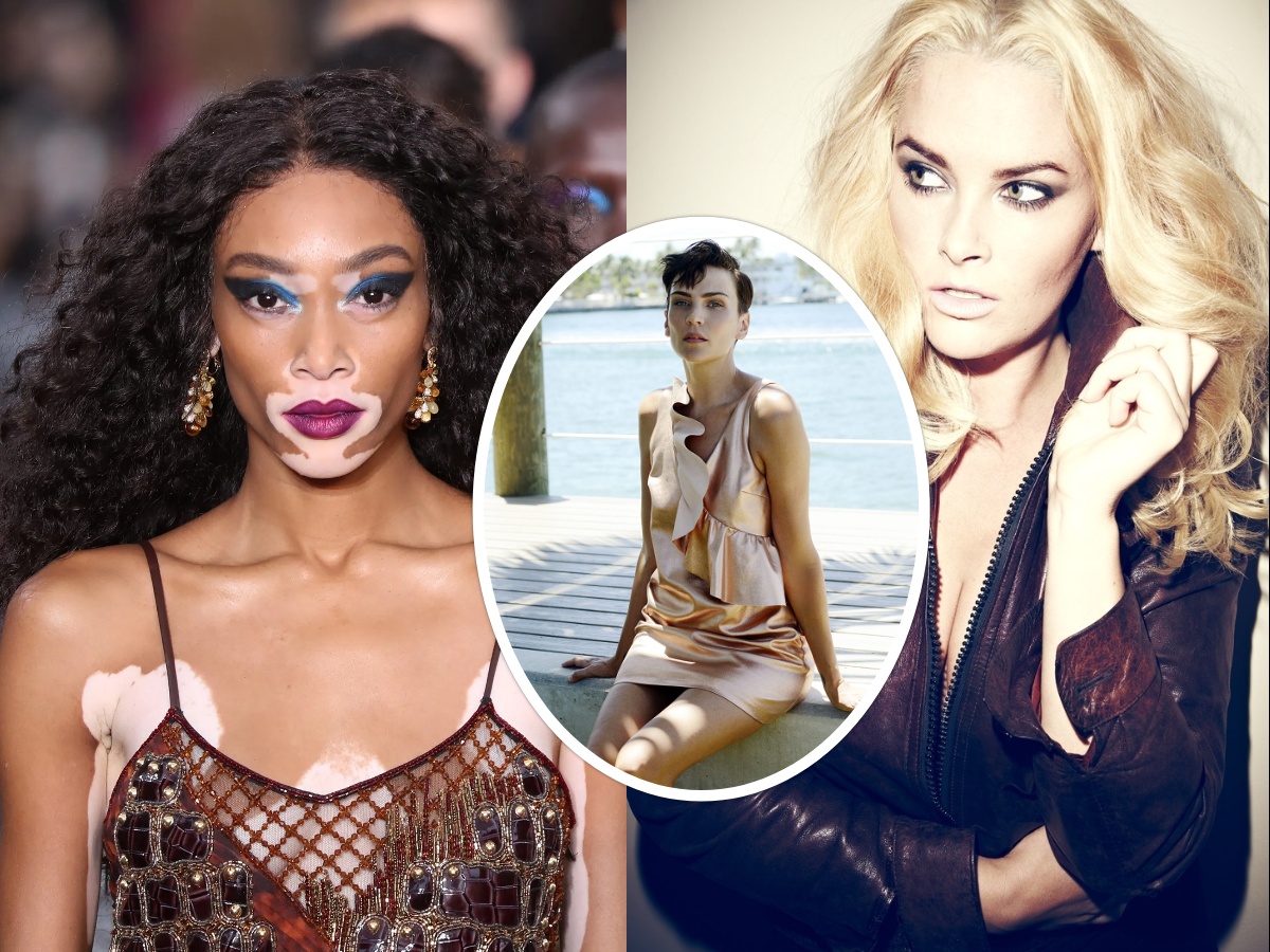 ANTM Mollie Whitney Harlow